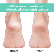 Anti Crack Silicon Gel Heel Moisturizing Socks for Foot Care Men Women (Loose Pack)